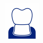 Emax Crowns