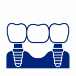 Implant-Supported Restorations​